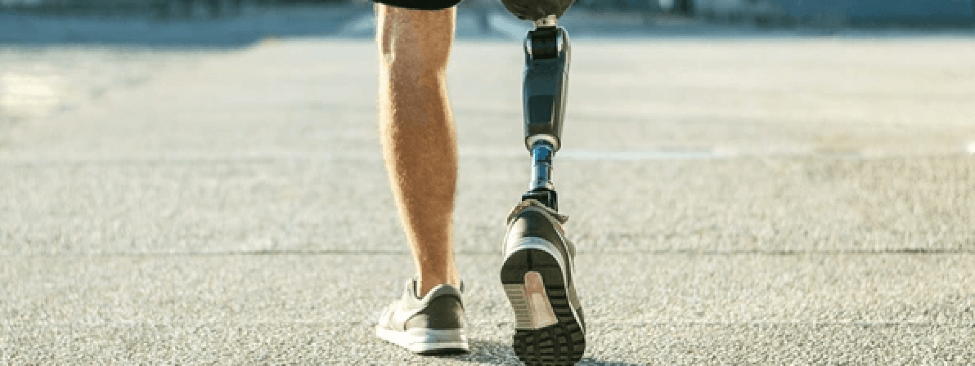 Vormingsdag pre- en post-amputatiezorg onderste lidmaat - editie 2 cover image